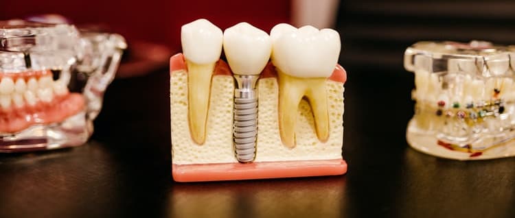 Análise e Desenvolvimento de Sistemas